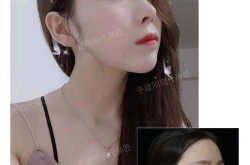 网红修鼻,揭秘美丽背后的秘密